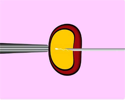 多囊卵巢综合症肥胖怎么办~私人做试管代怀